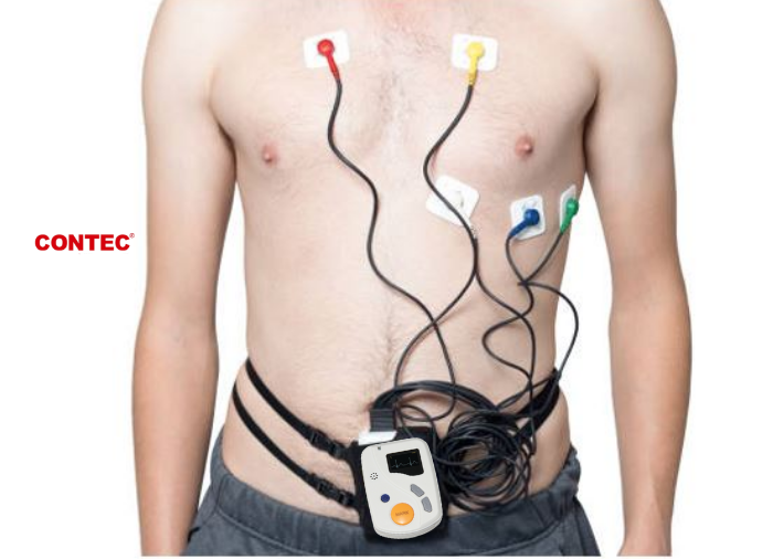 Holter Holter de arritmia: Posee 48 horas de registro continuo sin interrupciones,Software integrado para la interpretación del estudio incluyendo arritmias, isquemia miocárdica, predicción de arritmias malignas y muerte cardiáca súbita.