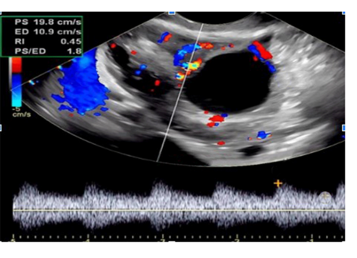 Eco Doppler: Software integrado con módulos para la observación y diagnóstico de múltiples estructuras del cuerpo humano