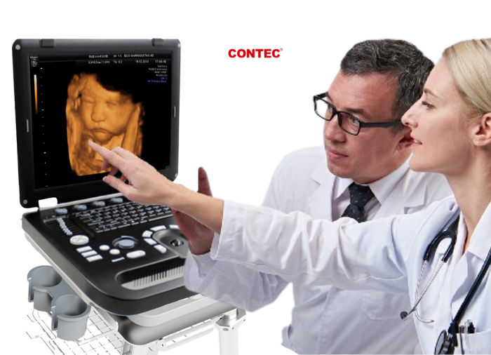 Ecógrafo doppler color, Ecógrafo 3D, 4D, Ecógrafo portátil doppler