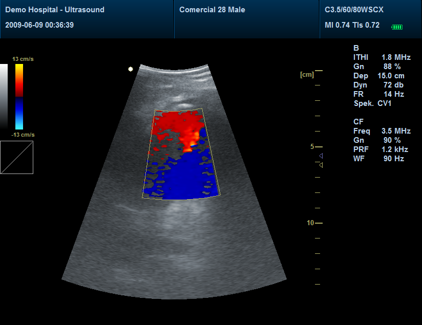 Ecógrafo doppler color, Ecógrafo Contec, Ecógrafo Cardiológico, Ecógrafo Contec