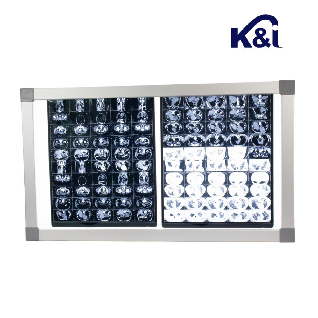 Negatoscopio dos cuerpos, luz LED. KI