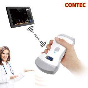 Ecografo de mano doppler color, dual transductor. Contec