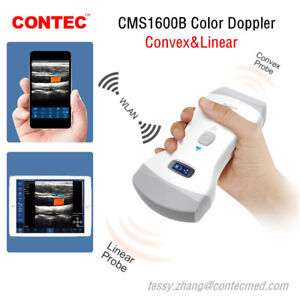 Ecografo de mano doppler color, dual transductor. Contec