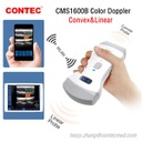 Ecografo de mano doppler color, dual transductor. Contec