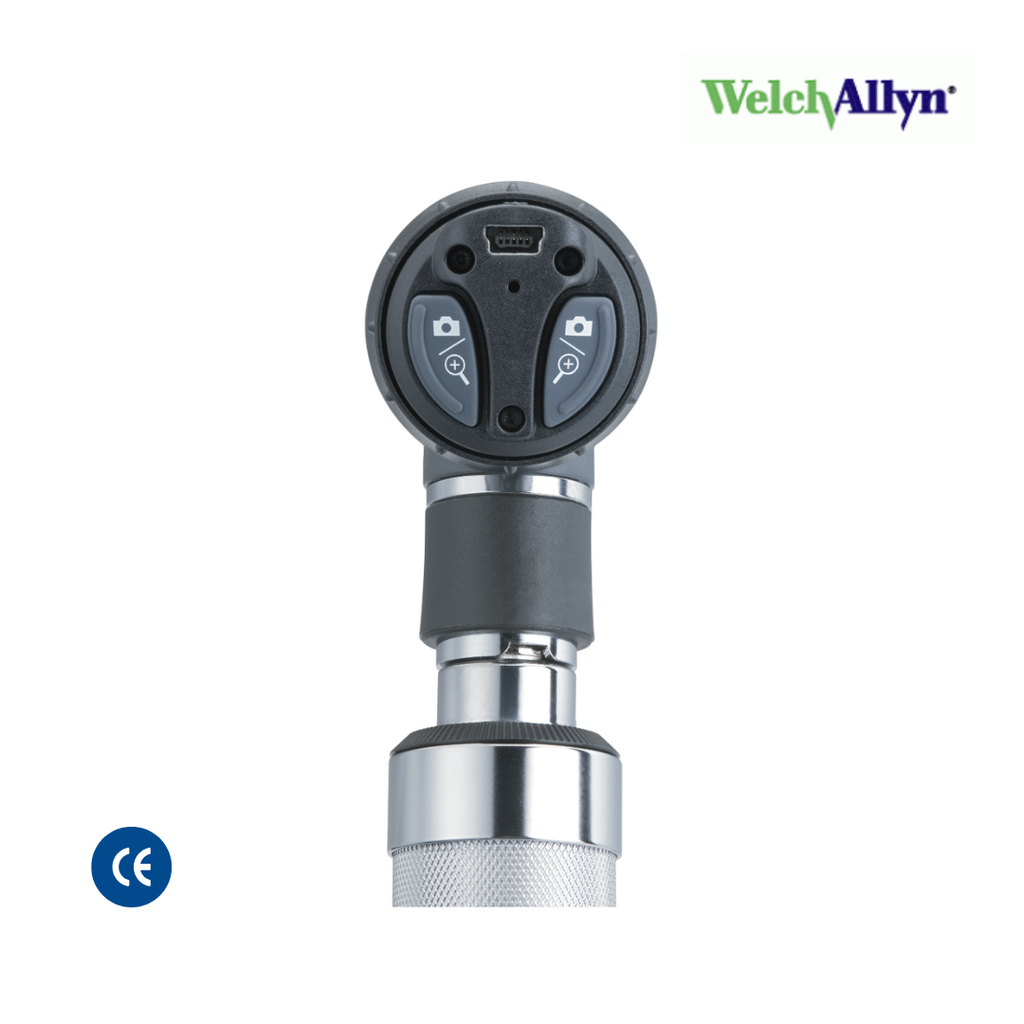 Video Otoscopio digital MacroView. Welch Allyn