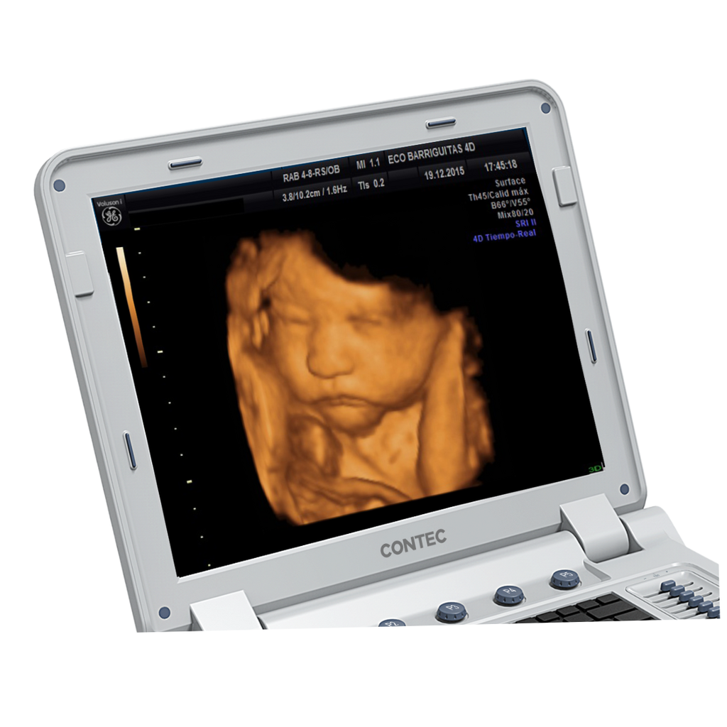 Ecografo Doppler color 3D, 4D. .png