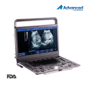 Ecografo Doppler color. Advanced DUS-5000+