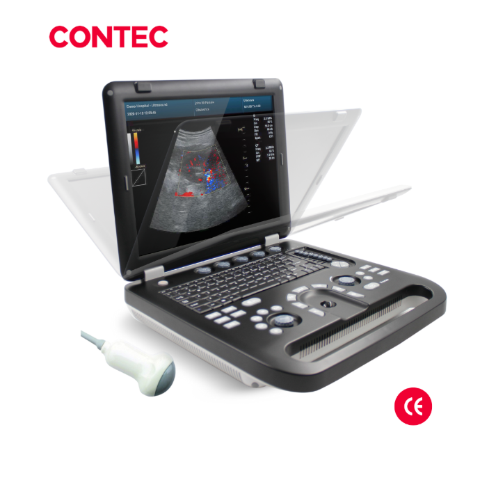 Ecografo Doppler color 3D, 4D. CONTEC CMS1700B
