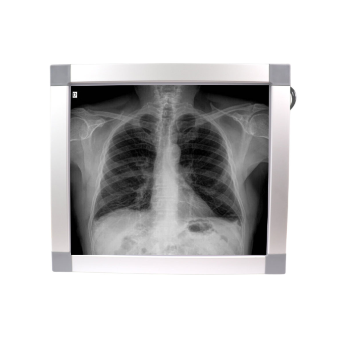 Negatoscopio 1 cuerpo, luz LED. KI