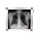 Negatoscopio 1 cuerpo, luz LED. KI