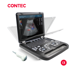 [CMS1700B-C2-OV] Ecografo Doppler color 3D, 4D. CONTEC CMS1700B