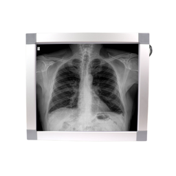 [KIXR1] Negatoscopio 1 cuerpo, luz LED. KI